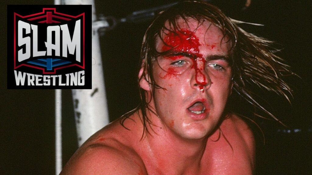 A bloody Barry Windham. Photo by Brad McFarlin